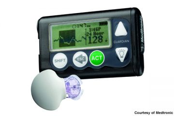 Use of Continuous Glucose Monitors in Pre-Diabetes & T2D Exercise Adherence